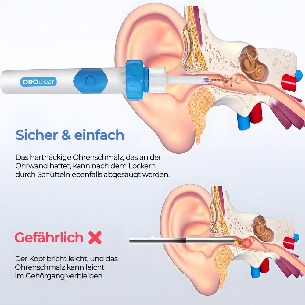 OROclear® Ohrenschmalz-Absauggerät